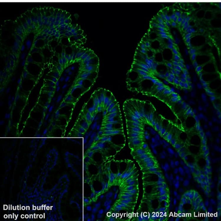 Anti-Occludin antibody [EPR20992](AB216327)