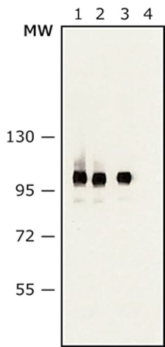 Anti-Sarcomeric Alpha Actinin antibody [EA-53](AB9465)
