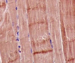 Mterf Antibody Epr14202 Ab181836  Immunohistochemistry Formalin Pfa Fixed Paraffin Embedded Sections Img105054