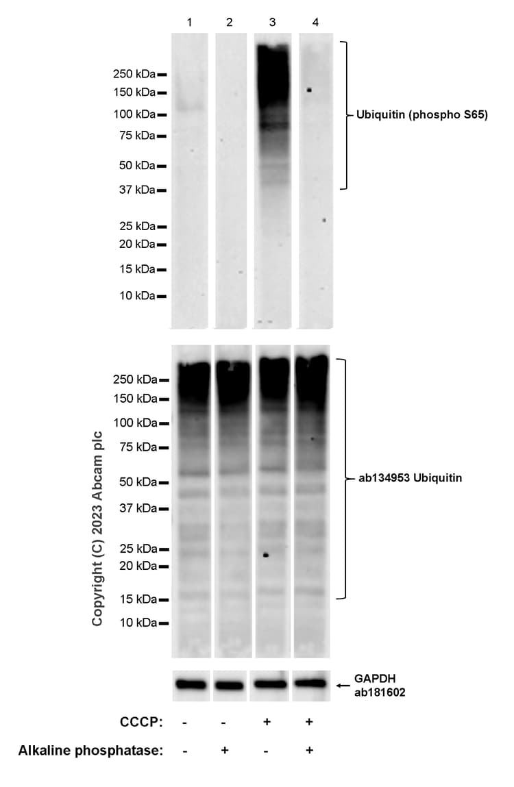 Anti-Ubiquitin (phospho S65) antibody [30H3/30K1](AB309155)