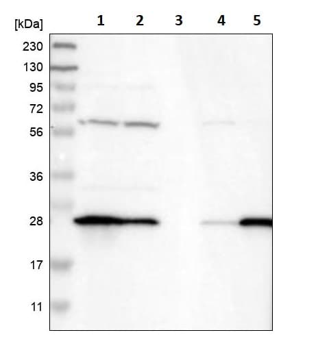 Anti-GST3 / GST pi antibody(AB259373)