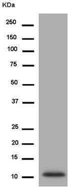 Alpha Defensin 5 Antibody Epr14309b Ab180515  Western Blot Img58142