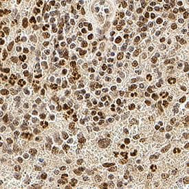 Anti-IRE1 (phospho S724) antibody(AB48187)