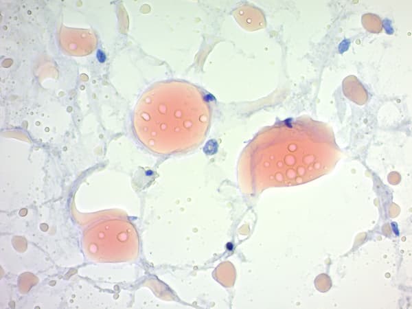 Oil Red O Stain Kit (Lipid Stain)(AB150678)