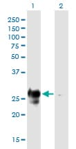 Anti-MHC Class II antibody [6C6](AB55152)