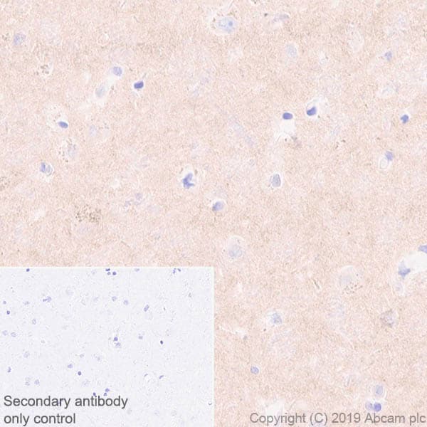 Anti-Pan Trk antibody [EPR17341-4](ab246551)