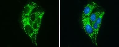 Abat Gaba T Antibody Ab152134  Immunocytochemistry Immunofluorescence Img452077