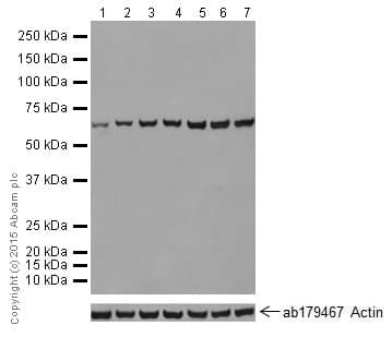 Hsp70 Antibody Epr17677 Ab182844  Western Blot Img11319