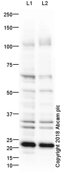 Anti-LAMP2B antibody - Lysosome Marker(AB18529)