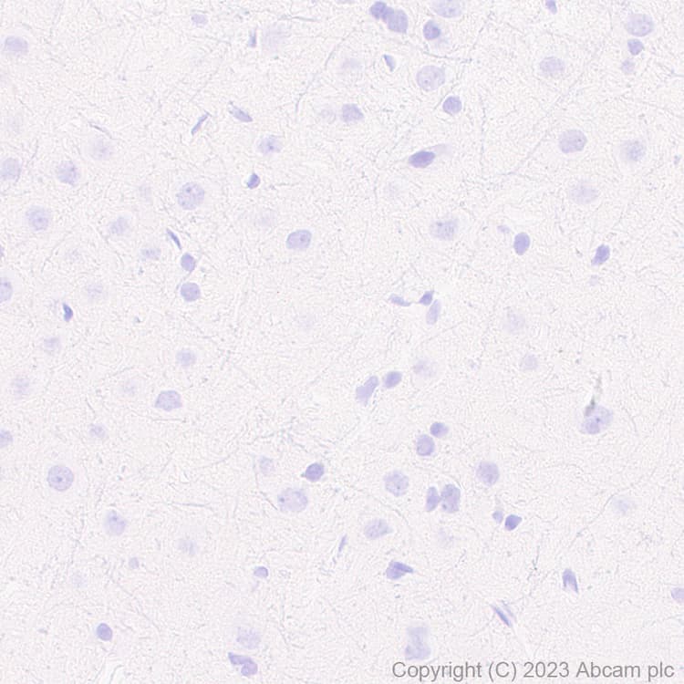 Anti-Neutrophil Elastase antibody [RM1077](AB314916)