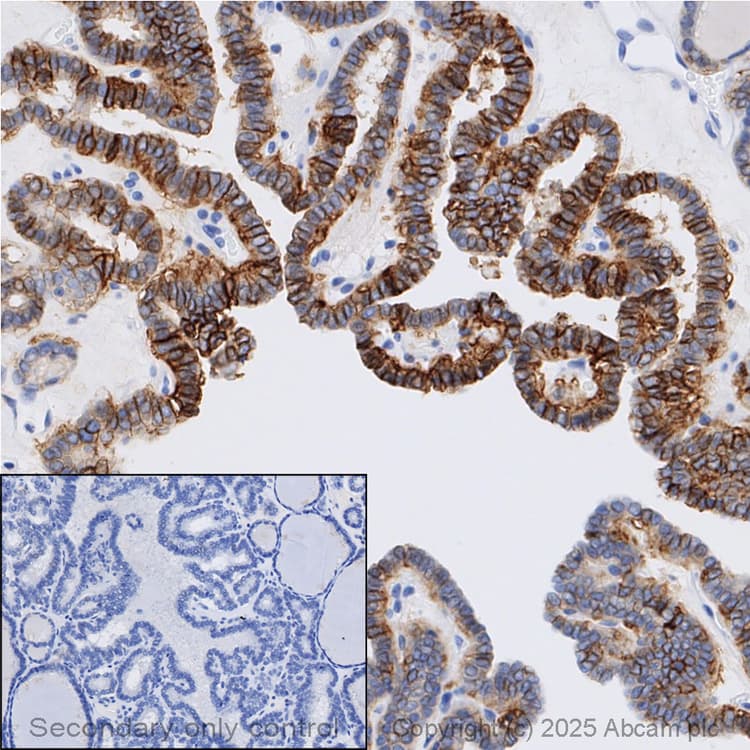 Anti-EpCAM antibody [EPR20532-225](AB223582)