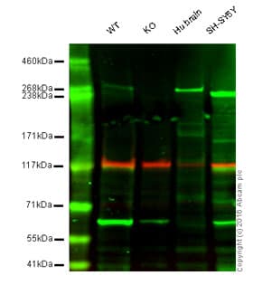 Anti-IP3 receptor antibody [EPR4537](AB108517)
