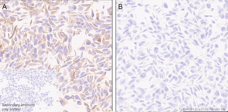 Ifit1 Antibody Epr27276 63 Bsa And Azide Free Ab305302  Immunohistochemistry Formalin Pfa Fixed Paraffin Embedded Sections Img405043