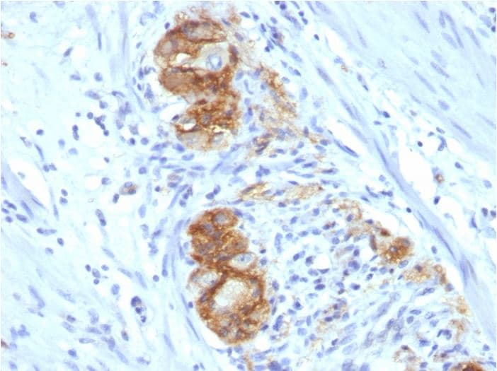 Anti-NCAM1 antibody [123C3.D5](AB270248)