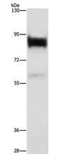 Anti-Lactoferrin antibody(AB197811)