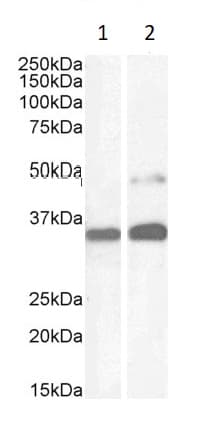 Anti-PAX8 antibody(AB13611)