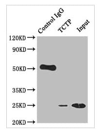 Tctp Antibody 10a9 Ab314167  Immunoprecipitation Img420940