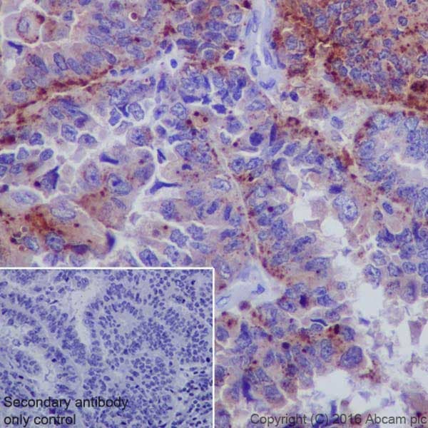 Anti-Niemann Pick C2 antibody [EPR19993] - BSA and Azide free(AB271975)