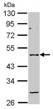Anti-GABA A Receptor alpha 2/GABRA2 antibody(AB153980)