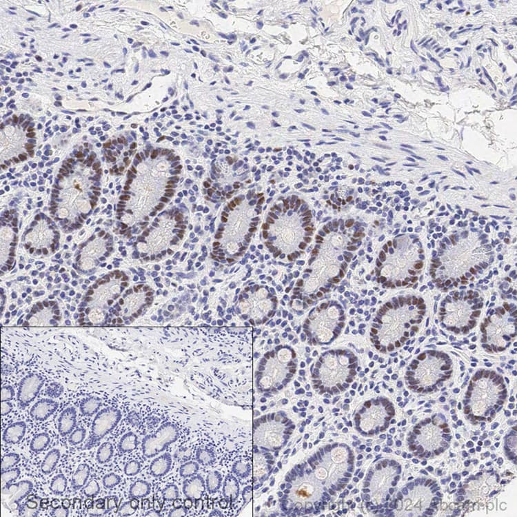 Anti-MSH6 antibody [EPR3945](AB92471)