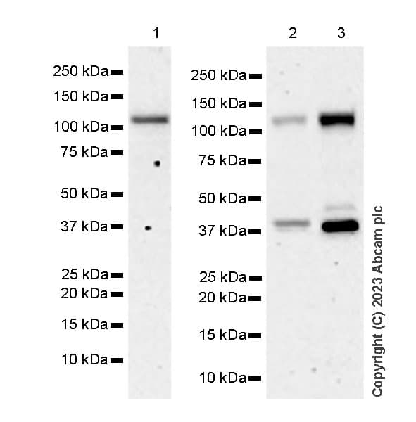 Anti-CBLB antibody [EPR28082-32](AB315021)