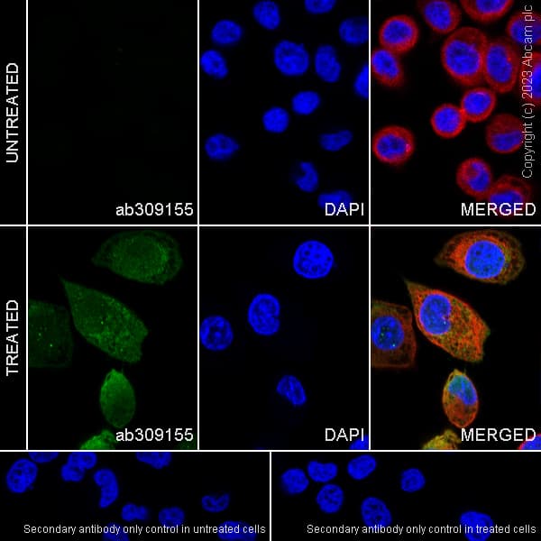 Anti-Ubiquitin (phospho S65) antibody [30H3/30K1](AB309155)