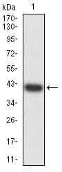 Anti-PAR1/Thrombin Receptor antibody [5E2E6](AB233741)