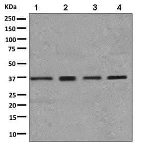 Gale Antibody Epr11088b Bsa And Azide Free Ab249240  Western Blot Img110611