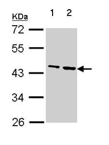 Anti-Fibrinogen gamma chain antibody(AB137728)
