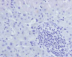 Anti-Androgen Receptor antibody [ER179(2)] - ChIP Grade(AB108341)