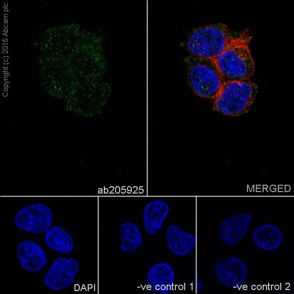 Anti-TNIP2 antibody [EPR17434](AB205925)