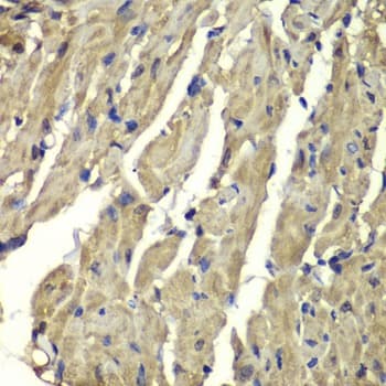 Anti-Frataxin antibody(AB175402)