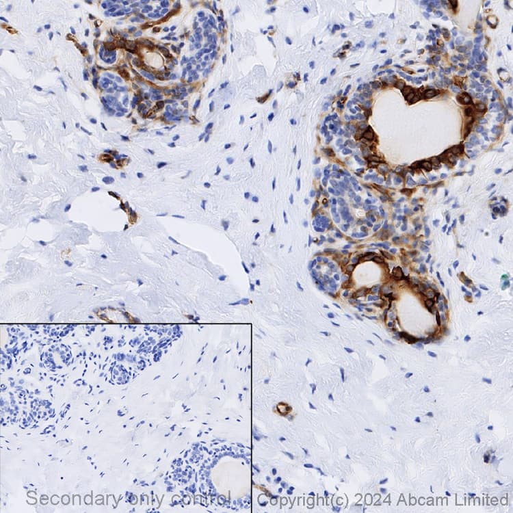 Anti-beta III Tubulin antibody [EP1569Y] - Neuronal Marker(AB52623)