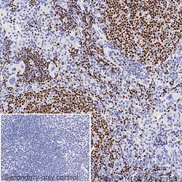 Pax5 Antibody 1h9 Ab211293  Immunohistochemistry Formalin Pfa Fixed Paraffin Embedded Sections Img18459