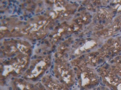 Anti-Ferritin Heavy Chain antibody(AB231253)
