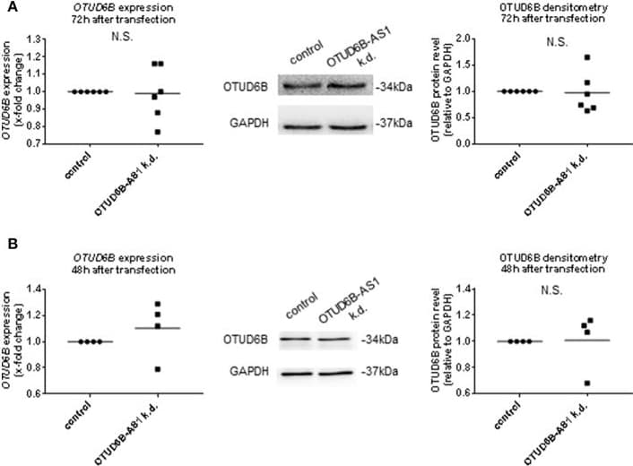Anti-OTUD6B antibody(AB127714)