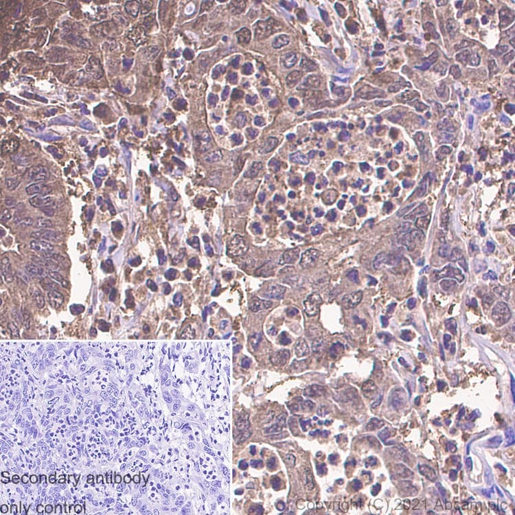 S100 Alpha 6 Pra Antibody Epr13084 69 Bsa And Azide Free Ab250543  Immunohistochemistry Formalin Pfa Fixed Paraffin Embedded Sections Img174823