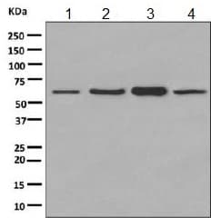Pkm Antibody Epr10139 Ab154816  Western Blot Img103670