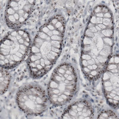 Anti-NIFK antibody [CL2240] - Nucleolar Marker(AB211871)