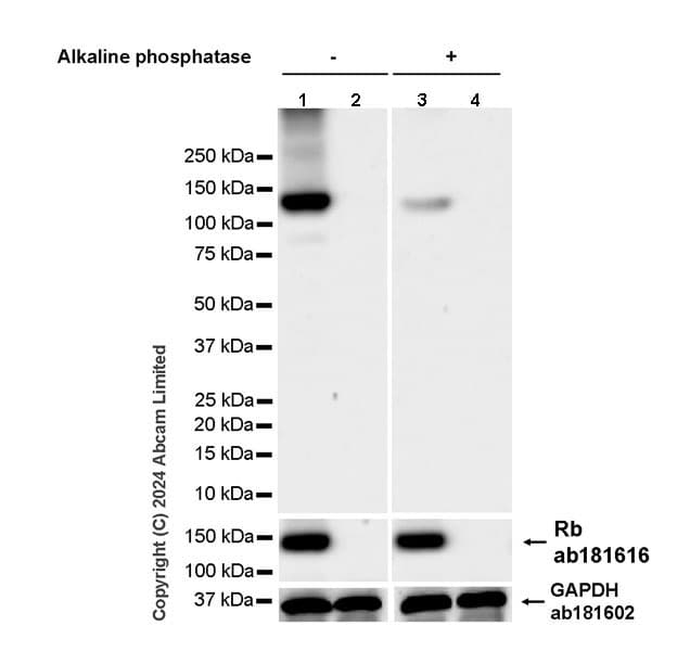 Anti-Rb antibody [EPR17512](AB181616)