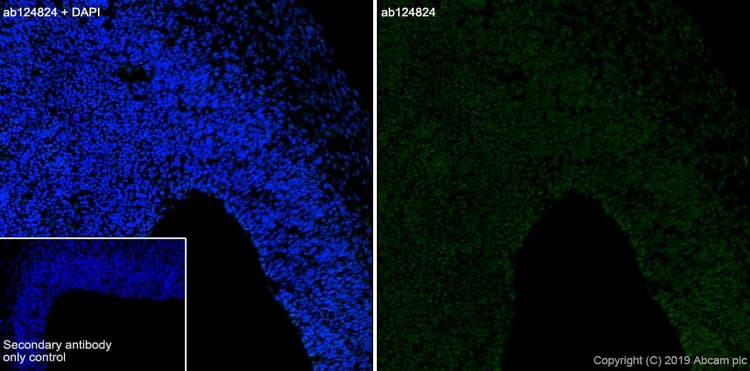 Anti-CXCR4 antibody [UMB2](AB124824)