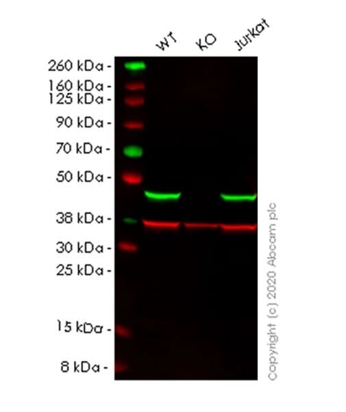 Set7 Antibody Epr23775 142 Ab274416  Western Blot Img5860