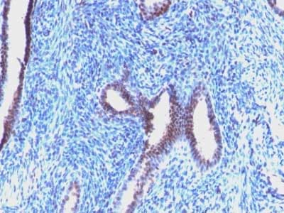 Cyclin B1 Antibody Ccnb1 1098 Ab212977  Immunohistochemistry Formalin Pfa Fixed Paraffin Embedded Sections Img64668