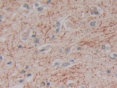 Anti-Kallikrein 2/KLK2 antibody(ab232980)