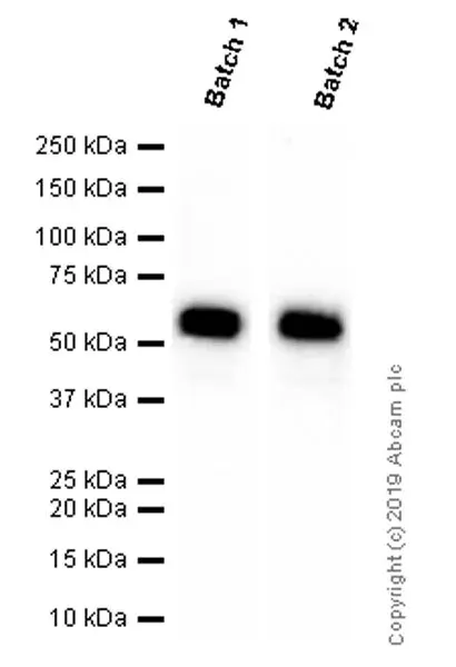 Anti-Cytokeratin 5 antibody [EP1601Y] - Cytoskeleton Marker(AB52635)