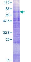 Recombinant Human Glucose Transporter GLUT4 protein(AB159519)
