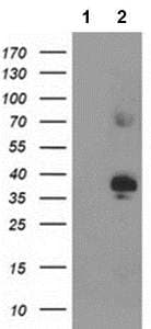 Anti-SIRT6 antibody [OTI1G3](AB119007)