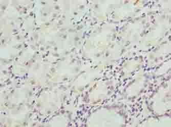Kiaa1737 Cipc Antibody Ab235359  Immunohistochemistry Formalin Pfa Fixed Paraffin Embedded Sections Img88699