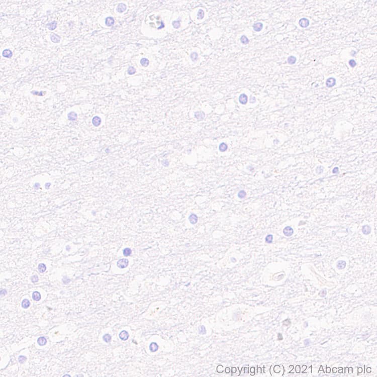 Anti-Langerin antibody [EPR24685-12](AB283686)