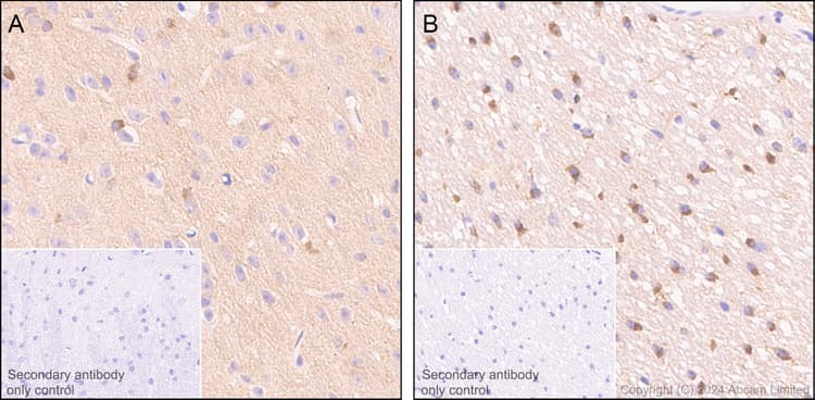 Anti-Tau (MTBR-tau243) antibody [EPR29541-59](AB322554)